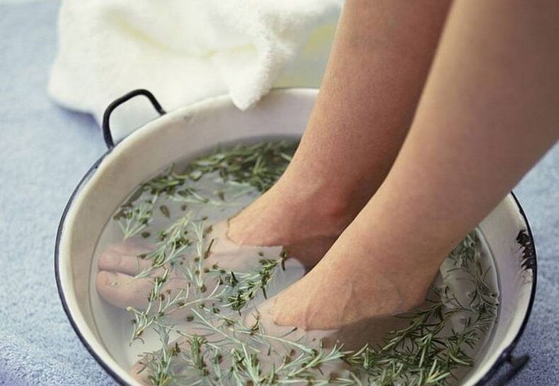 Kąpiel z wywarem ziołowym na grzybicę paznokci