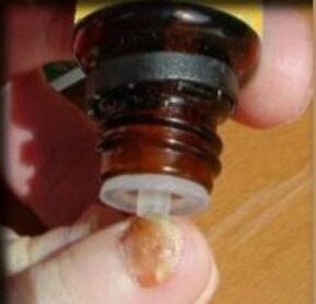 Nakładanie kropli na paznokieć dotknięty grzybem