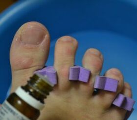 Przygotowanie do leczenia paznokci kroplami przeciwgrzybiczymi